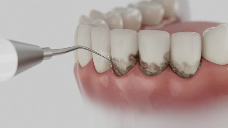 Reliable Wisdom Tooth Removal contractor in Davidson County County, NC by Dentist Open Now